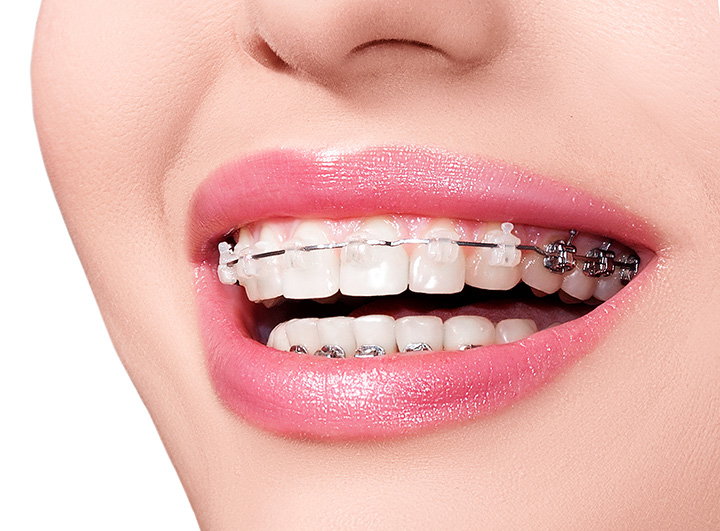 photodune-3832683-female-assistant-with-dentist-working-in-the-background-s